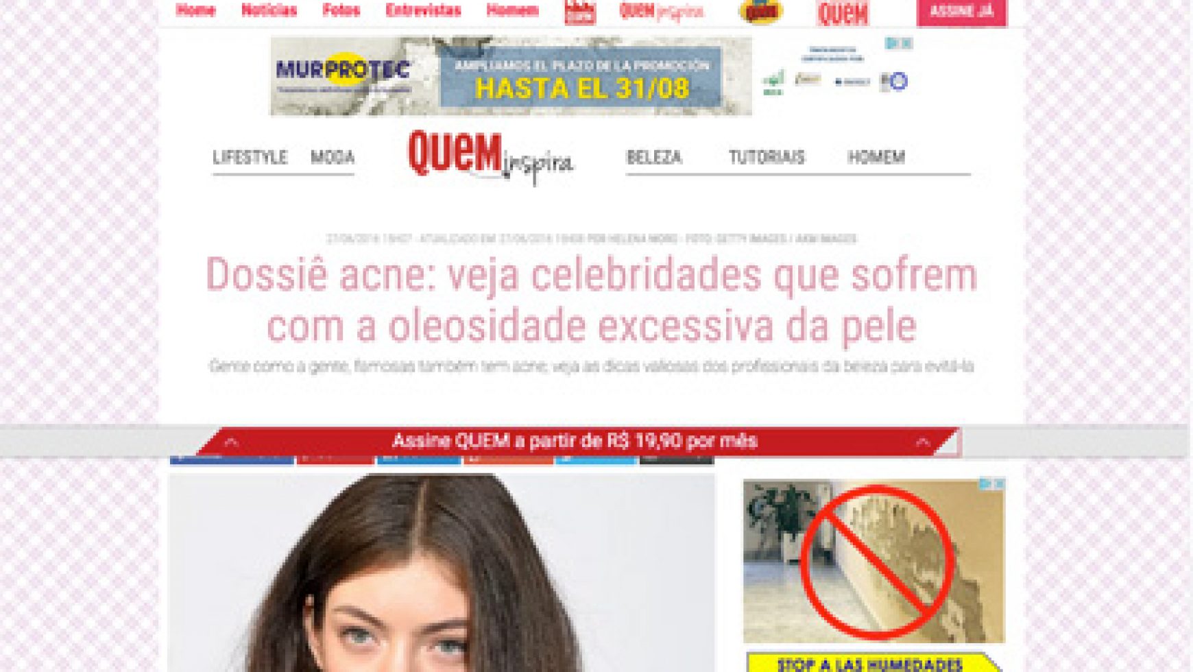 Dossiê acne: veja celebridades que sofrem com a oleosidade excessiva da pele